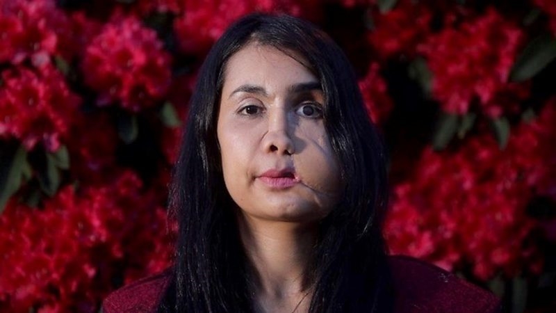 Eşi tarafından suratından vurulan Şakila Zareen, Afganistan`da kadınlara olan bakış açısını anlattı
