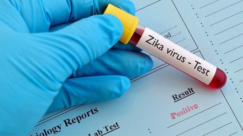 Bağışlanan tüm kanlarda Zika virüsü bakılacak