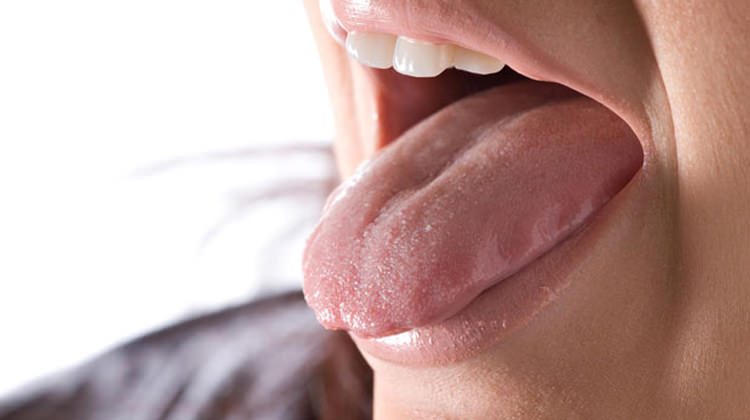 Dildeki yaralar ne anlama geliyor? Kanser belirtisi mi?