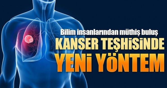 Göğüs kanserine DNA ile erken teşhis