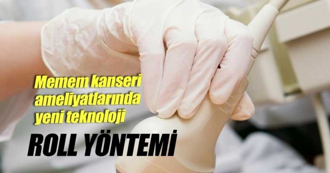 MEME KANSERİ AMELİYATLARINDA YENİ BİR TEKNOLOJİ: ROLL YÖNETİMİ