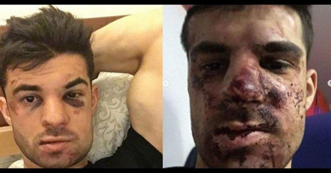 Rus futbolcu Terentyev`i otomobilinde dövdüler