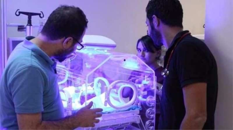 Siirt'te 'yılan bebek' dünyaya geldi