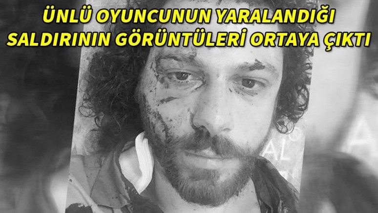 Ünlü oyuncu Oral Özer`in yaralandığı bar saldırısının görüntüleri ortaya çıktı